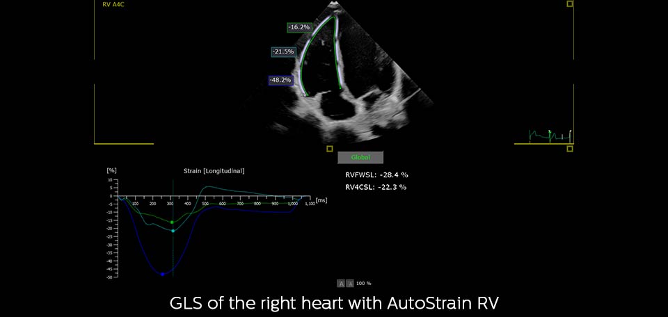 as rv analysis