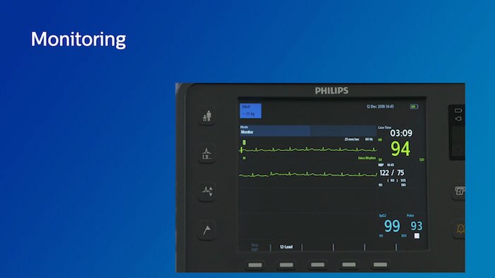 Monitoring-using the HeartStart Intrepid monitor and defibrillator video
