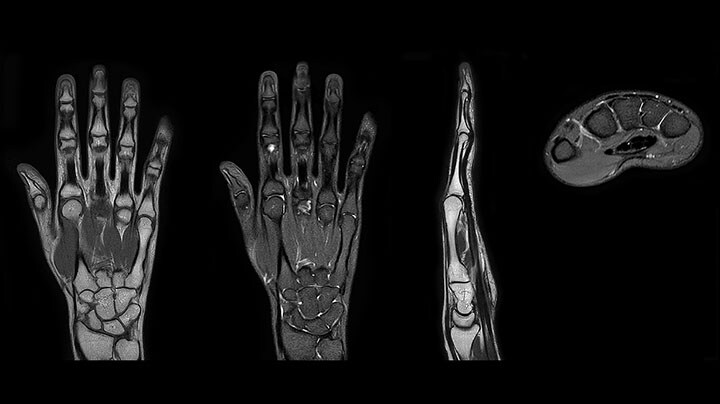 Hand & wrist MRI