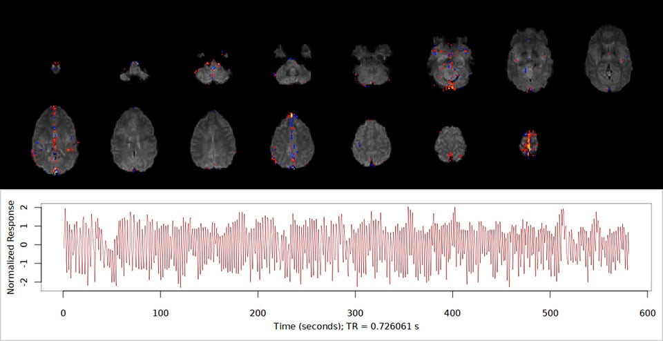 MultiBand SENSE fMRI physiological noise timecourse
