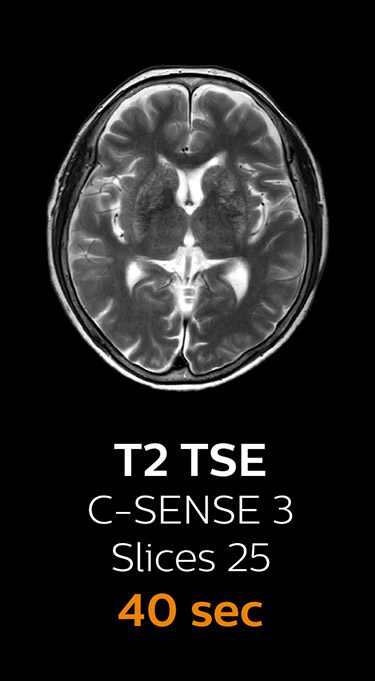 T2 TSE magnetic resonance imaging