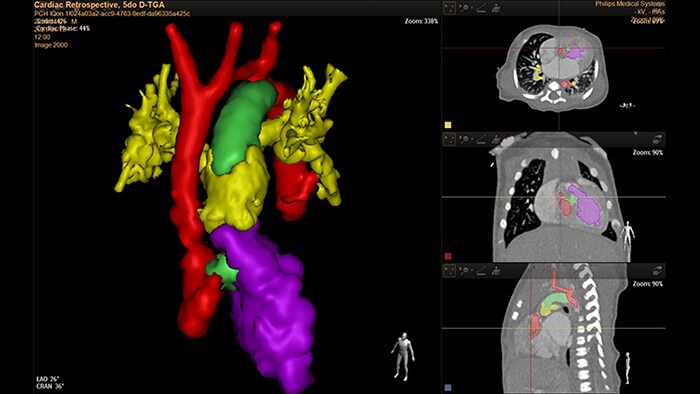 cardiac-retrospective-thumb