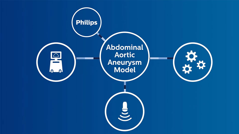 Abdominal Aortic Aneurysm video