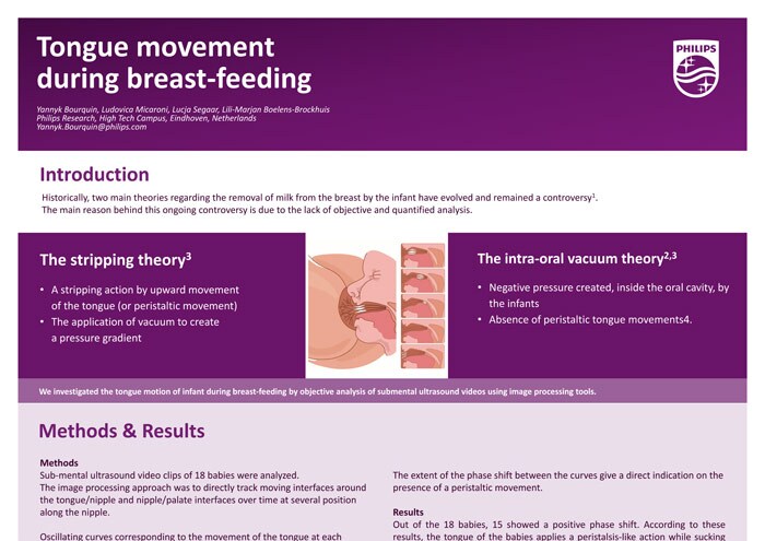 Poster avent symposium Bm 20200511