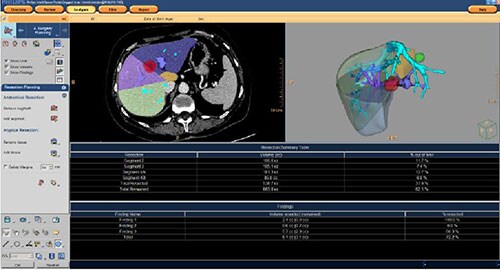 Computed tomography principle image