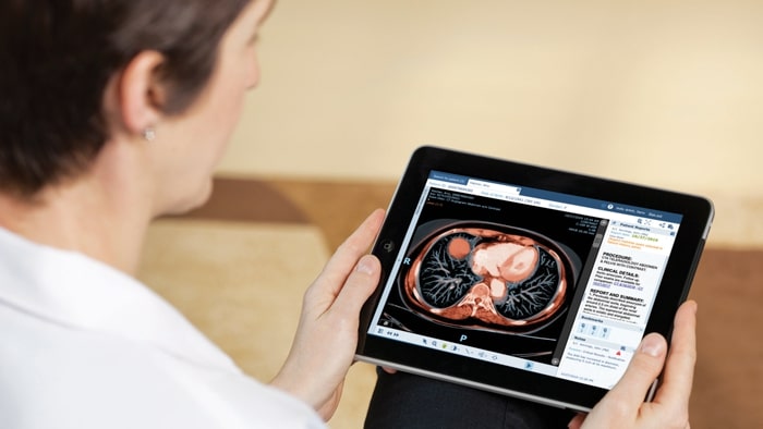 philips clinician with ipad enterprise viewer